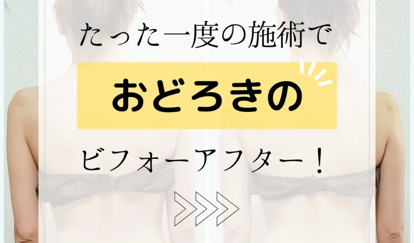 たった一度の施術で驚きのビフォーアフター！