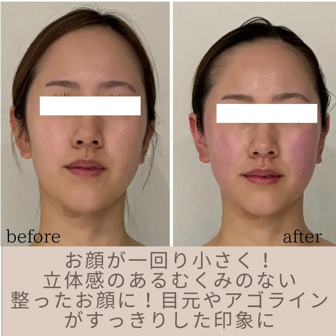 👗ブライダル限定コルギコース👗