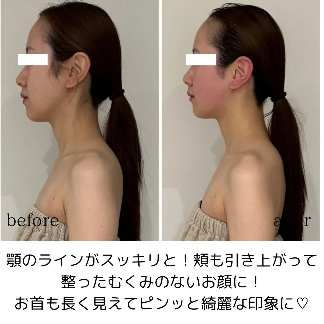 👗ブライダル限定コルギコース👗