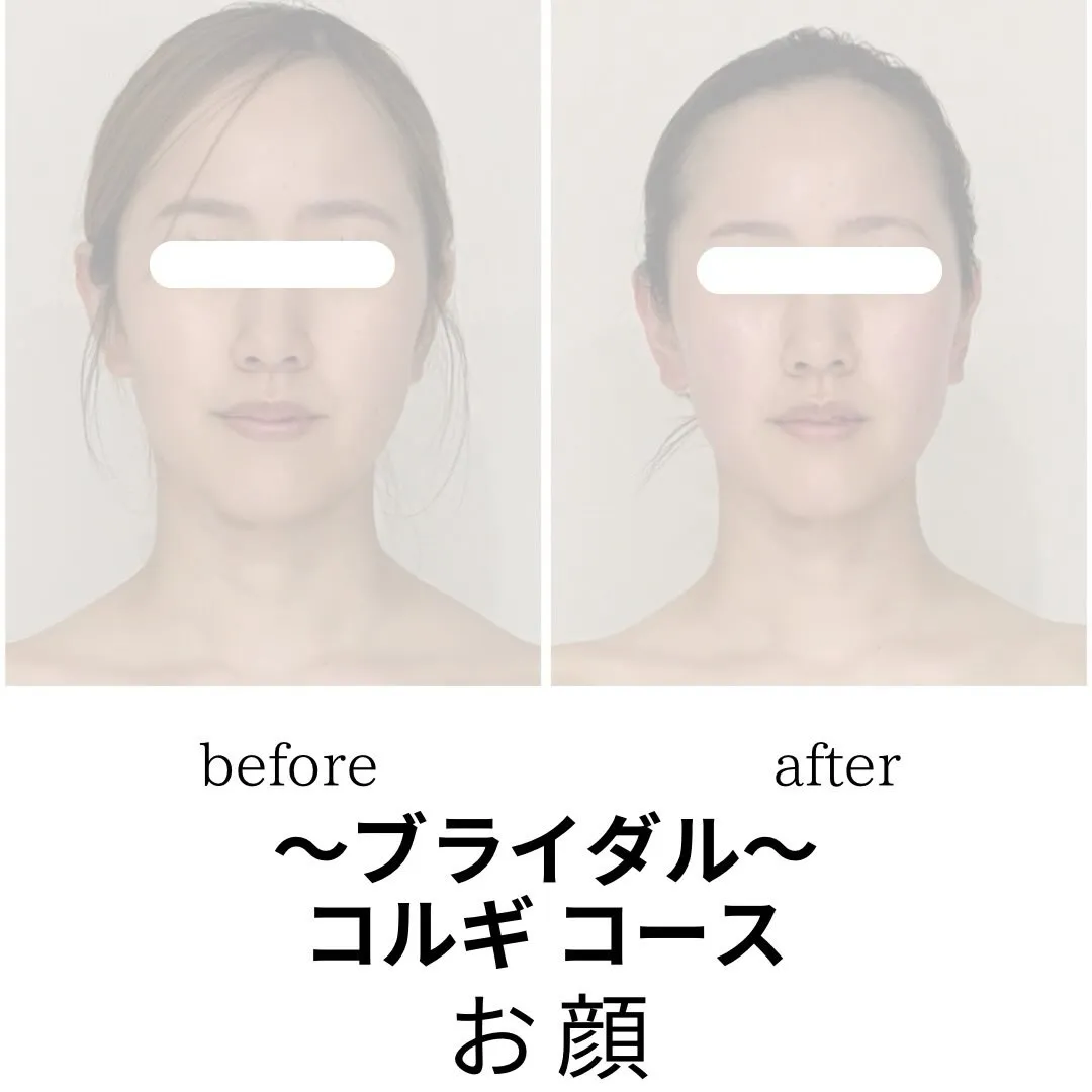 👗ブライダル限定コルギコース👗