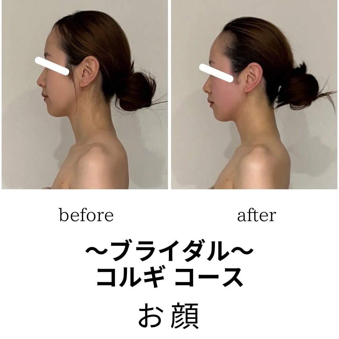 👗ブライダル限定コルギコース👗