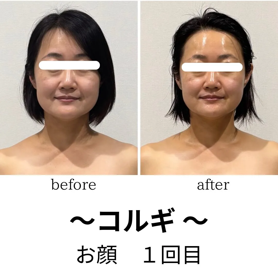 éclatの温潤コルギ