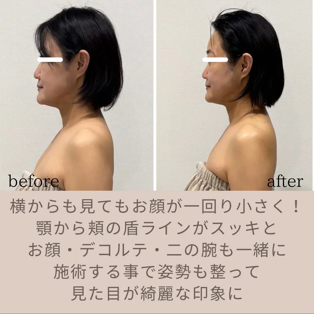 éclatの温潤コルギ